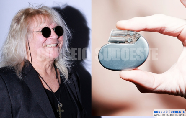 Cantor-Ovelha-e-o-marcapasso:-cardiologista-esclarece-dúvidas-sobre-o-dispositivo